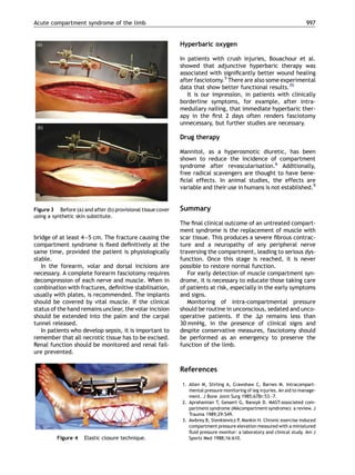 Acute compartment syndrome of the limb                                                                                  997


                                                             Hyperbaric oxygen

                                                             In patients with crush injuries, Bouachour et al.
                                                             showed that adjunctive hyperbaric therapy was
                                                             associated with signiﬁcantly better wound healing
                                                             after fasciotomy.5 There are also some experimental
                                                             data that show better functional results.35
                                                                It is our impression, in patients with clinically
                                                             borderline symptoms, for example, after intra-
                                                             medullary nailing, that immediate hyperbaric ther-
                                                             apy in the ﬁrst 2 days often renders fasciotomy
                                                             unnecessary, but further studies are necessary.

                                                             Drug therapy

                                                             Mannitol, as a hyperosmotic diuretic, has been
                                                             shown to reduce the incidence of compartment
                                                             syndrome after revascularisation.6 Additionally,
                                                             free radical scavengers are thought to have bene-
                                                             ﬁcial effects. In animal studies, the effects are
                                                             variable and their use in humans is not established.9


Figure 3 Before (a) and after (b) provisional tissue cover   Summary
using a synthetic skin substitute.
                                                             The ﬁnal clinical outcome of an untreated compart-
                                                             ment syndrome is the replacement of muscle with
bridge of at least 4—5 cm. The fracture causing the          scar tissue. This produces a severe ﬁbrous contrac-
compartment syndrome is ﬁxed deﬁnitively at the              ture and a neuropathy of any peripheral nerve
same time, provided the patient is physiologically           traversing the compartment, leading to serious dys-
stable.                                                      function. Once this stage is reached, it is never
   In the forearm, volar and dorsal incisions are            possible to restore normal function.
necessary. A complete forearm fasciotomy requires               For early detection of muscle compartment syn-
decompression of each nerve and muscle. When in              drome, it is necessary to educate those taking care
combination with fractures, deﬁnitive stabilisation,         of patients at risk, especially in the early symptoms
usually with plates, is recommended. The implants            and signs.
should be covered by vital muscle. If the clinical              Monitoring of intra-compartmental pressure
status of the hand remains unclear, the volar incision       should be routine in unconscious, sedated and unco-
should be extended into the palm and the carpal              operative patients. If the Dp remains less than
tunnel released.                                             30 mmHg, in the presence of clinical signs and
   In patients who develop sepsis, it is important to        despite conservative measures, fasciotomy should
remember that all necrotic tissue has to be excised.         be performed as an emergency to preserve the
Renal function should be monitored and renal fail-           function of the limb.
ure prevented.

                                                             References

                                                             1. Allen M, Stirling A, Crawshaw C, Barnes M. Intracompart-
                                                                mental pressure monitoring of leg injuries. An aid to manage-
                                                                ment. J Bone Joint Surg 1985;67Br:53—7.
                                                             2. Aprahamian T, Gessert G, Banoyk D. MAST-associated com-
                                                                partment syndrome (MAcompartment syndrome): a review. J
                                                                Trauma 1989;29:549.
                                                             3. Awbrey B, Stenkiewicz P, Mankin H. Chronic exercise induced
                                                                compartment pressure elevation measured with a miniatured
                                                                ﬂuid pressure monitor: a laboratory and clinical study. Am J
         Figure 4    Elastic closure technique.                 Sports Med 1988;16:610.
 