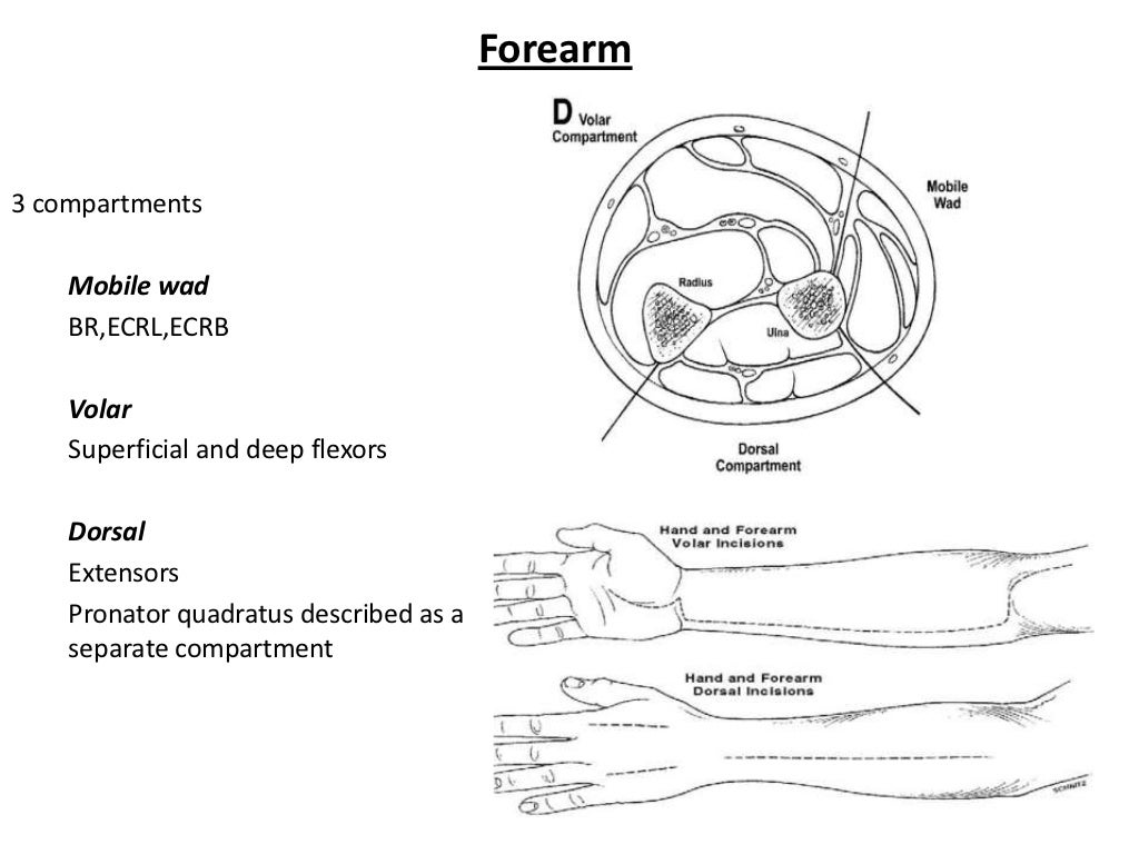 Compartment syndrome