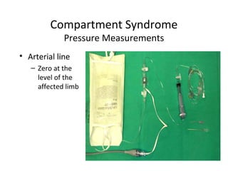 Compartment Syndrome
             Pressure Measurements
• Arterial line
   – Zero at the
     level of the
     affected limb
 