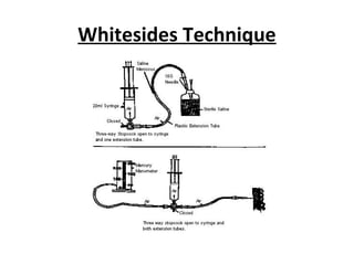 Whitesides Technique
 