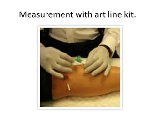 Measurement with art line kit.

 