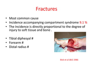 Fractures
• Most common cause
• Incidence accompanying compartment syndrome 9.1 %
• The Incidence is directly proportional to the degree of
injury to soft tissue and bone .
• Tibial diphesyal #
• Forearm #
• Distal radius #

Bick et al JBJS 1986

 