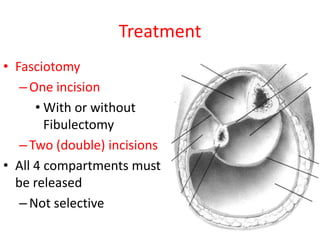 Treatment
• Fasciotomy
– One incision
• With or without
Fibulectomy
– Two (double) incisions
• All 4 compartments must
be released
– Not selective

 