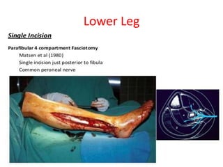 Lower Leg

 