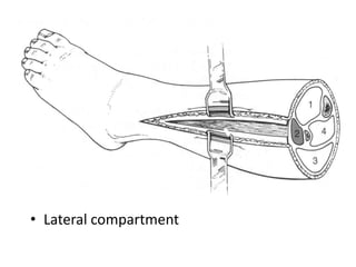 • Lateral compartment

 