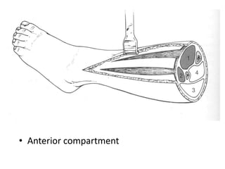 • Anterior compartment

 