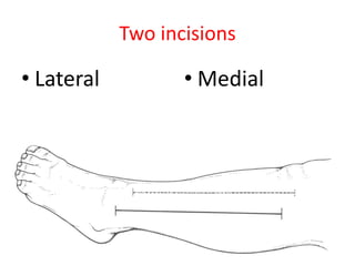Two incisions

• Lateral

• Medial

 