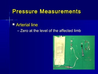 Pressure MeasurementsPressure Measurements
 Arterial lineArterial line
– Zero at the level of the affected limbZero at the level of the affected limb
 