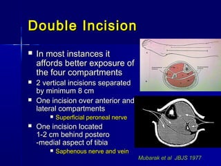 Double IncisionDouble Incision
 In most instances itIn most instances it
affords better exposure ofaffords better exposure of
the four compartmentsthe four compartments
 2 vertical incisions separated2 vertical incisions separated
by minimum 8 cmby minimum 8 cm
 One incision over anterior andOne incision over anterior and
lateral compartmentslateral compartments
 Superficial peroneal nerveSuperficial peroneal nerve
 One incision locatedOne incision located
1-2 cm behind postero1-2 cm behind postero
-medial aspect of tibia-medial aspect of tibia
 Saphenous nerve and veinSaphenous nerve and vein
Mubarak et al JBJS 1977
 