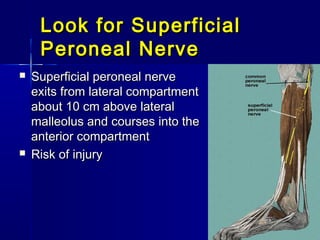 Look for SuperficialLook for Superficial
Peroneal NervePeroneal Nerve
 Superficial peroneal nerveSuperficial peroneal nerve
exits from lateral compartmentexits from lateral compartment
about 10 cm above lateralabout 10 cm above lateral
malleolus and courses into themalleolus and courses into the
anterior compartmentanterior compartment
 Risk of injuryRisk of injury
 