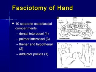  10 separate osteofascial10 separate osteofascial
compartmentscompartments
– dorsal interossei (4)dorsal interossei (4)
– palmar interossei (3)palmar interossei (3)
– thenar and hypothenarthenar and hypothenar
(2)(2)
– adductor pollicis (1)adductor pollicis (1)
Fasciotomy of HandFasciotomy of Hand
 