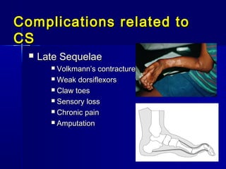 Complications related toComplications related to
CSCS
 Late SequelaeLate Sequelae
 Volkmann’s contractureVolkmann’s contracture
 Weak dorsiflexorsWeak dorsiflexors
 Claw toesClaw toes
 Sensory lossSensory loss
 Chronic painChronic pain
 AmputationAmputation
 