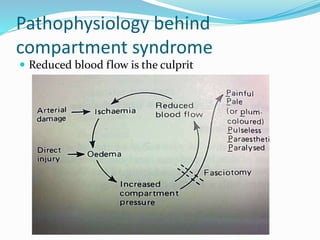 Pathophysiology behind
compartment syndrome
 Reduced blood flow is the culprit
 