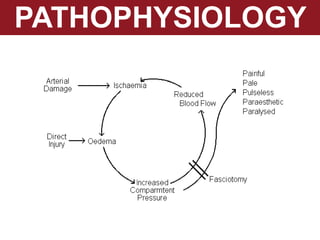PATHOPHYSIOLOGY
 