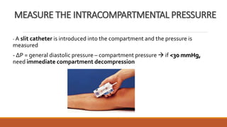 Compartment syndrome | PPTX