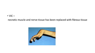 • VIC –
necrotic muscle and nerve tissue has been replaced with fibrous tissue
 