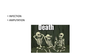 • INFECTION
• AMPUTATION
 