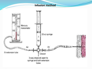 Infusion method
 
