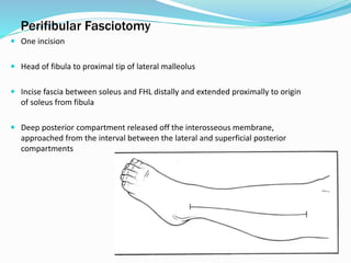Perifibular Fasciotomy
 One incision
 Head of fibula to proximal tip of lateral malleolus
 Incise fascia between soleus and FHL distally and extended proximally to origin
of soleus from fibula
 Deep posterior compartment released off the interosseous membrane,
approached from the interval between the lateral and superficial posterior
compartments
 