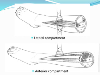  Lateral compartment
 Anterior compartment
 