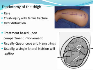 Fasciotomy of the thigh
 Rare
 Crush injury with femur fracture
 Over distraction
 Treatment based upon
compartment involvement
 Usually Quadriceps and Hamstrings
 Usually, a single lateral incision will
suffice
 
