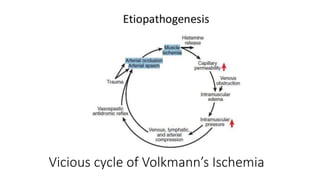 Vicious cycle of Volkmann’s Ischemia
 