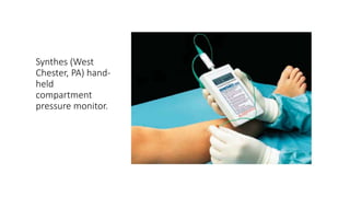Synthes (West
Chester, PA) hand-
held
compartment
pressure monitor.
 