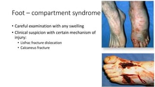 Foot – compartment syndrome
• Careful examination with any swelling
• Clinical suspicion with certain mechanism of
injury:
• Lisfrac fracture dislocation
• Calcaneus fracture
 