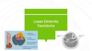 LowerExtremity
Fasciotomy
 