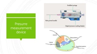 Presurre
measurement
device
 