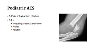 Compartment syndrome.ppt