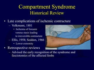 Compartment Syndrome
Historical Review
• Late complications of ischemic contracture
– Volkmann, 1881
• Ischemia of forearm
venous stasis leading
to irreversible contracture
– Ellis, 1958; Seddon, 1966
• Lower extremity
• Retrospective reviews
– Advised the early recognition of the syndrome and
fasciotomies of the affected limbs
 