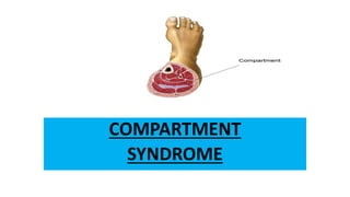 COMPARTMENT
SYNDROME
 