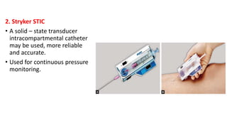 2. Stryker STIC
• A solid – state transducer
intracompartmental catheter
may be used, more reliable
and accurate.
• Used for continuous pressure
monitoring.
 