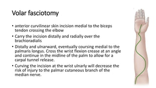 Volar fasciotomy
• anterior curvilinear skin incision medial to the biceps
tendon crossing the elbow
• Carry the incision distally and radially over the
brachioradialis
• Distally and ulnarward, eventually coursing medial to the
palmaris longus. Cross the wrist flexion crease at an angle
and continue in the midline of the palm to allow for a
carpal tunnel release.
• Curving the incision at the wrist ulnarly will decrease the
risk of injury to the palmar cutaneous branch of the
median nerve.
 
