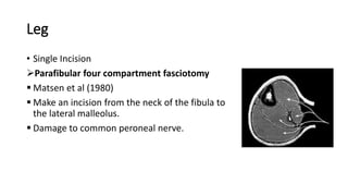 Leg
• Single Incision
Parafibular four compartment fasciotomy
 Matsen et al (1980)
 Make an incision from the neck of the fibula to
the lateral malleolus.
 Damage to common peroneal nerve.
 