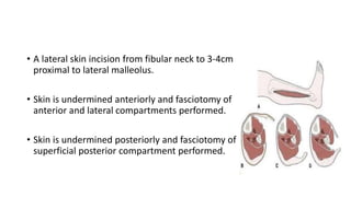 • A lateral skin incision from fibular neck to 3-4cm
proximal to lateral malleolus.
• Skin is undermined anteriorly and fasciotomy of
anterior and lateral compartments performed.
• Skin is undermined posteriorly and fasciotomy of
superficial posterior compartment performed.
 