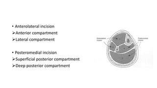 • Anterolateral incision
Anterior compartment
Lateral compartment
• Posteromedial incision
Superficial posterior compartment
Deep posterior compartment
 