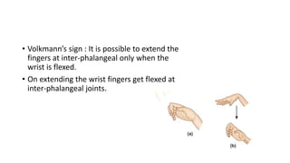 • Volkmann’s sign : It is possible to extend the
fingers at inter-phalangeal only when the
wrist is flexed.
• On extending the wrist fingers get flexed at
inter-phalangeal joints.
 