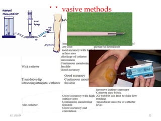 I. Invasive methods
3/11/2024 22
 