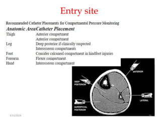 Entry site
3/11/2024 24
 