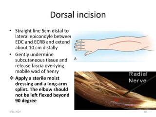 Dorsal incision
• Straight line 5cm distal to
lateral epicondyle between
EDC and ECRB and extend it
about 10 cm distally
• Gently undermine
subcutaneous tissue and
release fascia overlying
mobile wad of henry
 Apply a sterile moist
dressing and a long-arm
splint. The elbow should
not be left flexed beyond
90 degree
50
3/11/2024
 