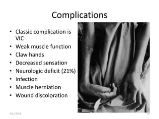 Complications
• Classic complication is
VIC
• Weak muscle function
• Claw hands
• Decreased sensation
• Neurologic deficit (21%)
• Infection
• Muscle herniation
• Wound discoloration
59
3/11/2024
 