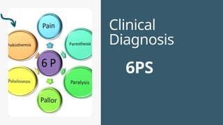 COMPARTMENT SYNDROME prepared by medical | PPTX