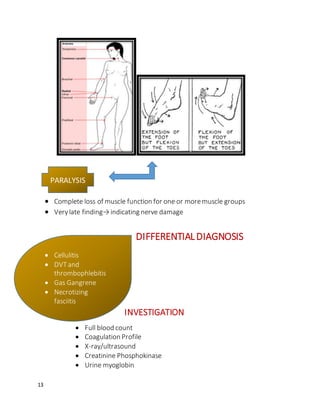 13
 Complete loss of muscle function for one or moremuscle groups
 Verylate finding→indicating nerve damage
DIFFERENTIALDIAGNOSIS
INVESTIGATION
 Full blood count
 Coagulation Profile
 X-ray/ultrasound
 Creatinine Phosphokinase
 Urine myoglobin
PARALYSIS
 Cellulitis
 DVTand
thrombophlebitis
 Gas Gangrene
 Necrotizing
fasciitis
 Peripheral
vascular injuries
 