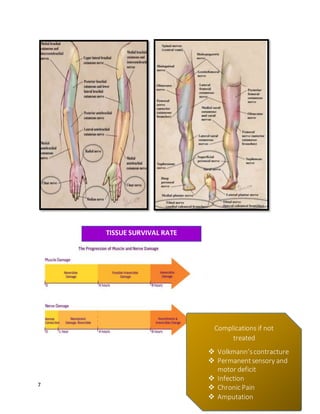 7
Complications if not
treated
 Volkmann’scontracture
 Permanentsensory and
motor deficit
 Infection
 Chronic Pain
 Amputation
TISSUE SURVIVAL RATE
 
