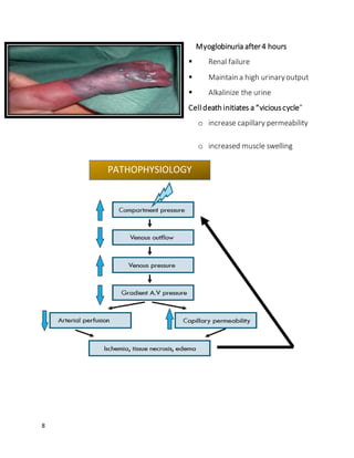 8
Myoglobinuria after4 hours
 Renal failure
 Maintain a high urinaryoutput
 Alkalinize the urine
Celldeath initiates a “viciouscycle”
o increase capillary permeability
o increased muscle swelling
PATHOPHYSIOLOGY
 