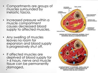 • Compartments are groups of
muscles surrounded by
inelastic fascia.
• Increased pressure within a
muscle compartment
causes decreased blood
supply to affected muscles.
• Any swelling of muscles
leaves no room for
expansion and blood supply
is progressively shut off.
• If affected muscles are
deprived of blood supply for
> 6 hours, nerve and muscle
tissue can be permanently
damaged.
 