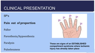 Compartment syndrome and VIC | PPTX