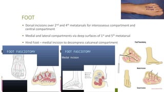 Foot Incision Compartment syndrome | PPTX